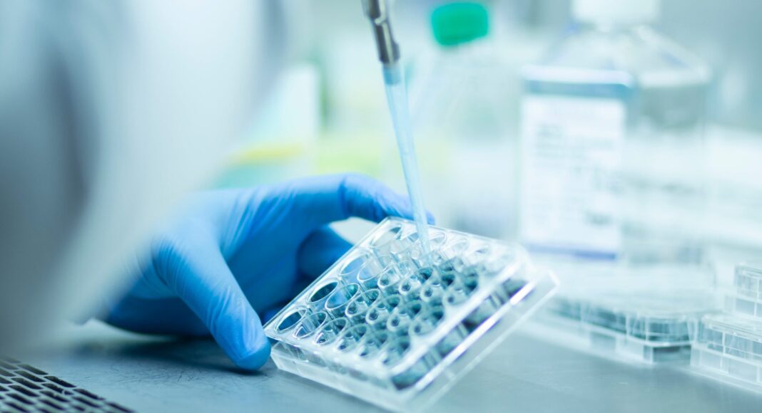 Consumabile de laborator: pipetă și plăci de analiză, ca cele pe care le cumpără Apavital